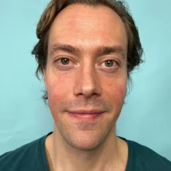 Jesper Sjölin