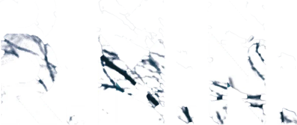 МРТ